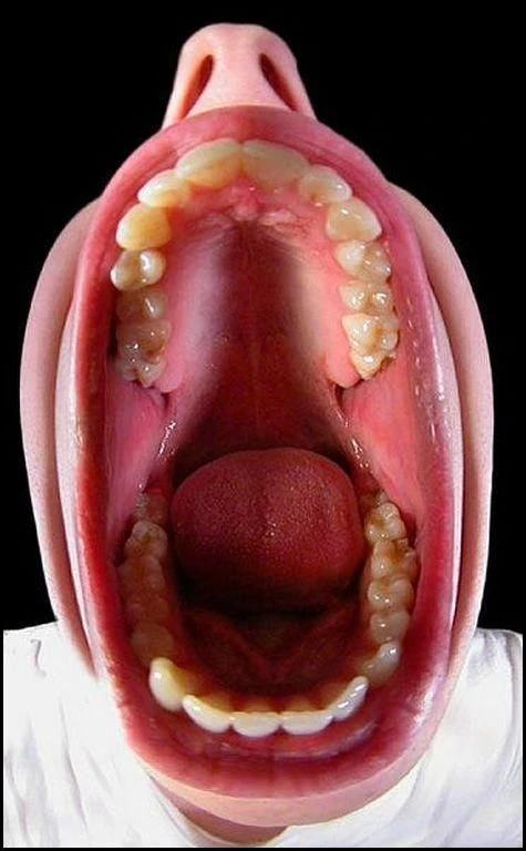 bigmouth